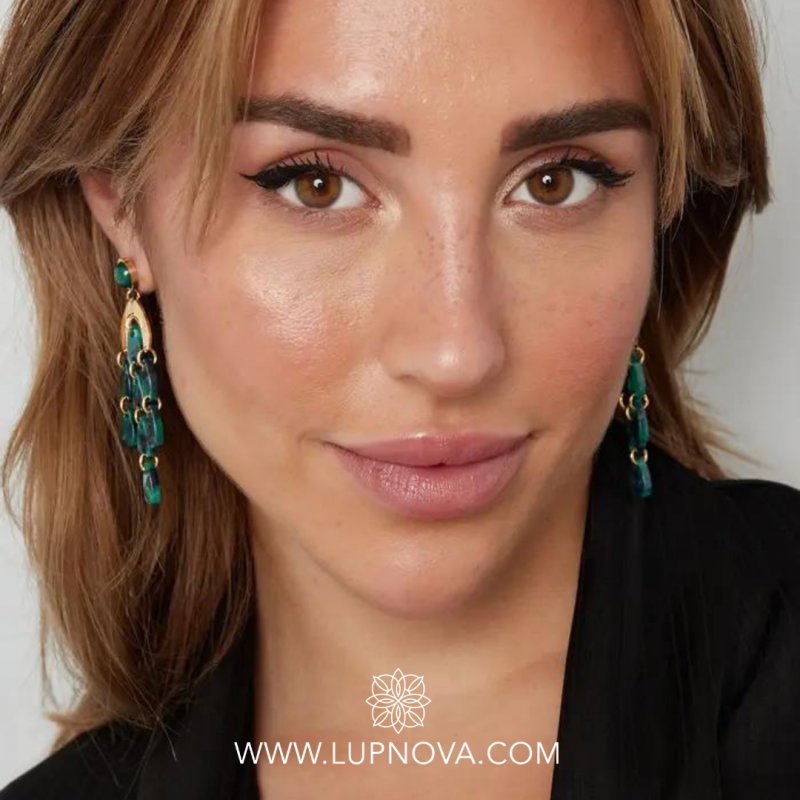 Aretes del bosque - Imagen 3